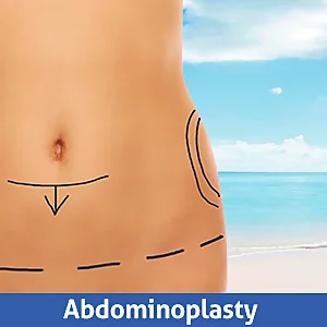 Abdominoplasty in Cancun