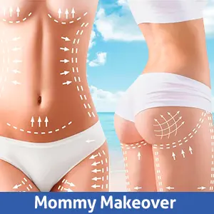 Mommy Makeover Cancun